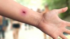 Health tracking microchip.