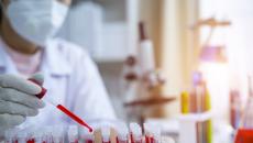 Clinician analyzing blood samples