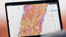 Deep Bio's prostate cancer analysis AI 